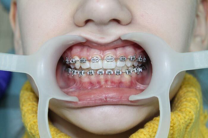 <span style="font-weight: bold;">ОРТОДОНТИЯ</span>