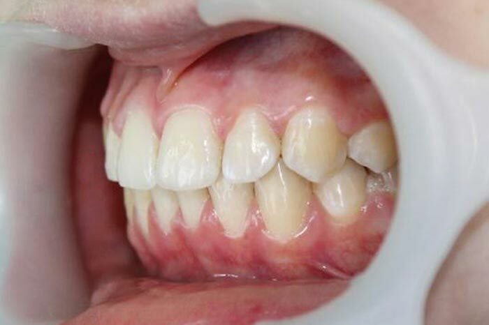 <span style="font-weight: bold;">ЛЕЧЕНИЕ ДЕСЕН</span>